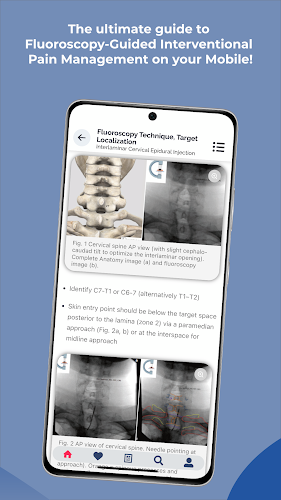 Interventional Pain App应用截图第3张