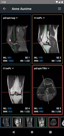 IDV - IMAIOS DICOM Viewer Zrzut ekranu 2