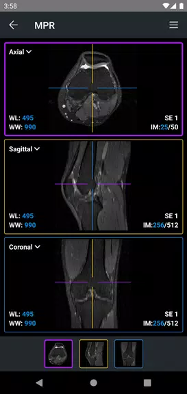 IDV - IMAIOS DICOM Viewer Capture d'écran 3