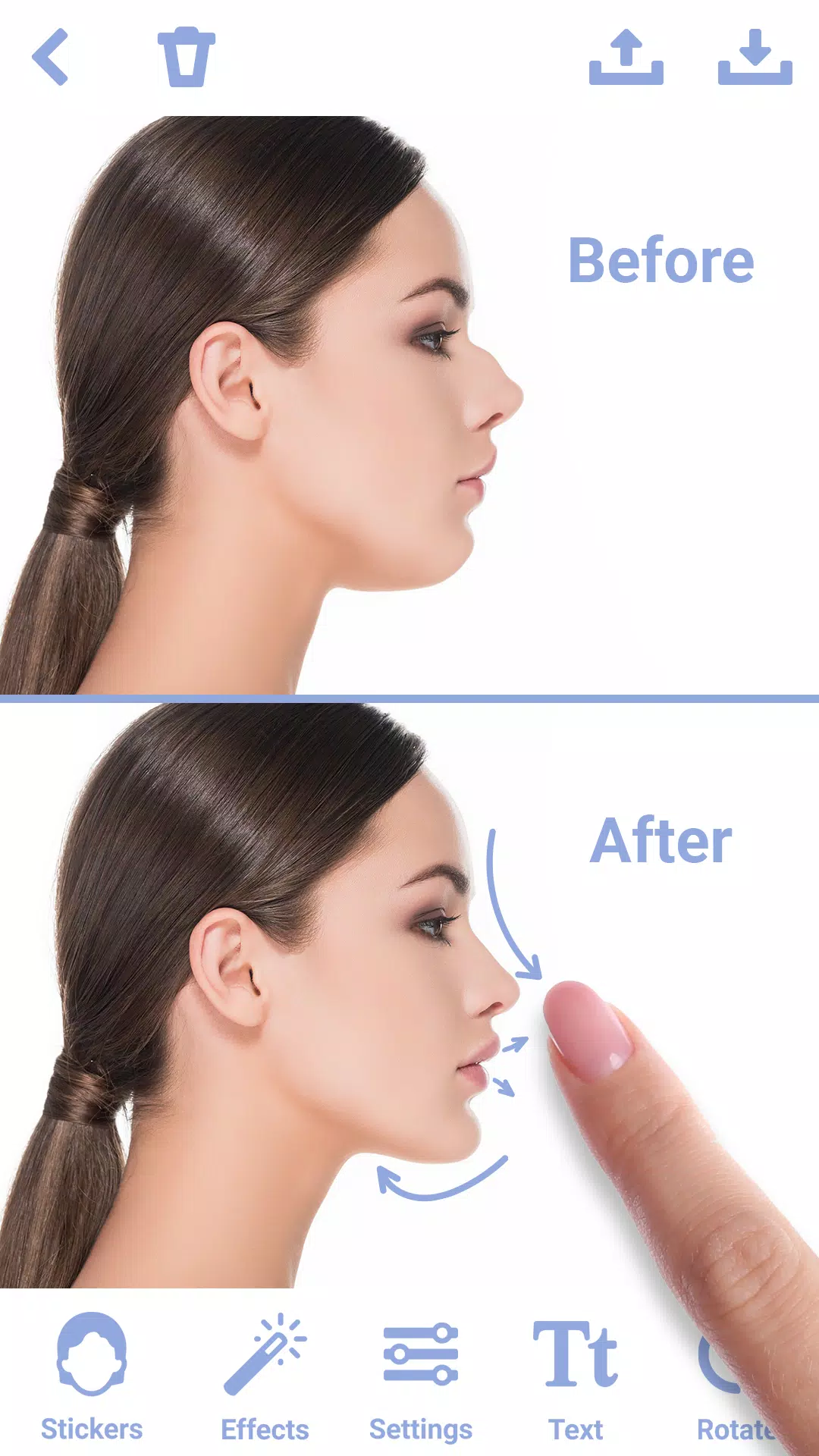 Rhinoplasty 스크린샷 0