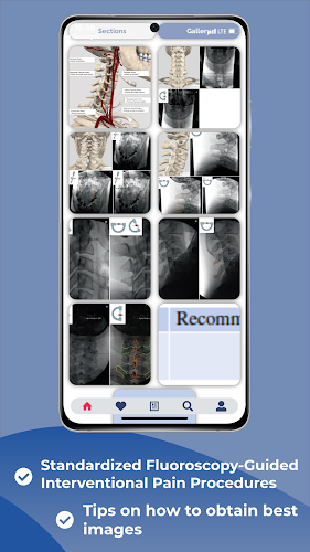 Interventional Pain App Schermafbeelding 2